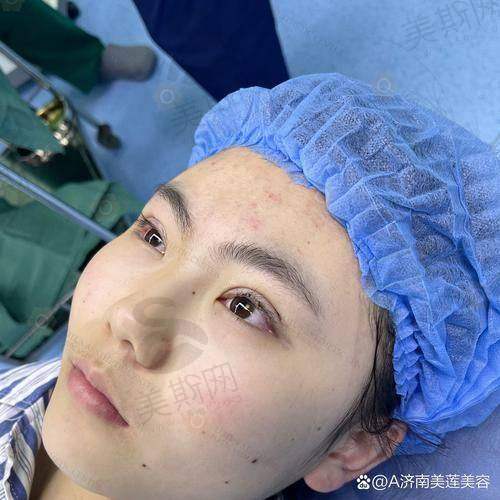 上海美诗沁去眼袋成效好吗？术后护理不当会影响成效吗？
