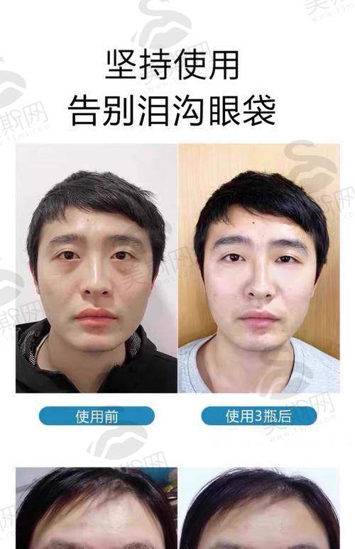 上海美诗沁去眼袋成效好吗？宣瑞军 医生团队为何口碑爆棚？