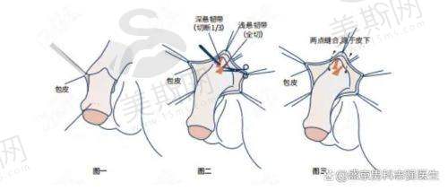 杭州阿波罗医院看男科 大约多少钱？医院资质与医生团队实力影响费用合理性
