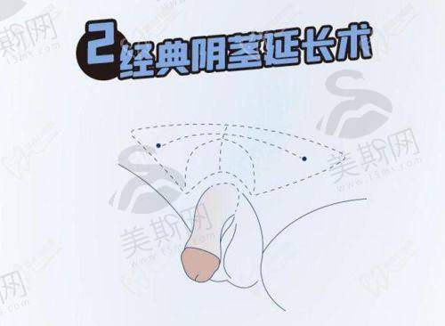 杭州阿波罗医院看男科 大约多少钱？医疗保险能报销吗？避坑要点请记好！