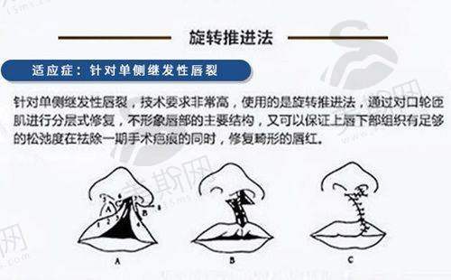 总结