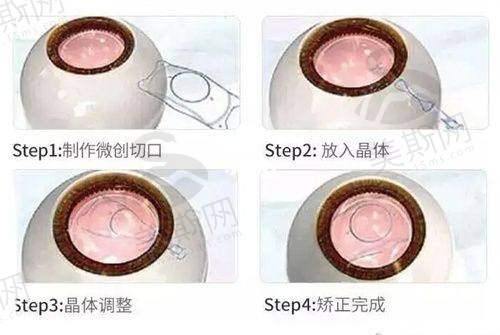 总结