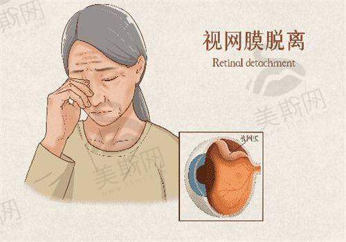 南宁爱尔眼科医院收费高低情况