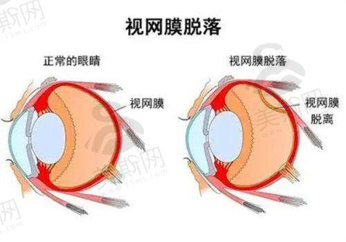 广西医 科 大学附属第一医院眼科门诊信息