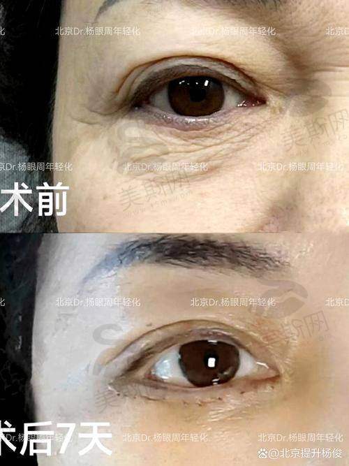 广州整容医院排行榜前十名电话
