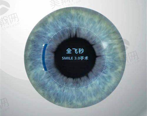 五、重庆南坪爱尔眼科怎么样?支撑smile全飞秒项目的医院优势