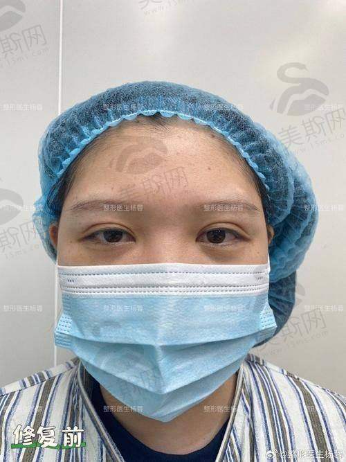 北京艺星王博谦简介大揭秘!医生技术、地址、价格表及电话信息全知晓!