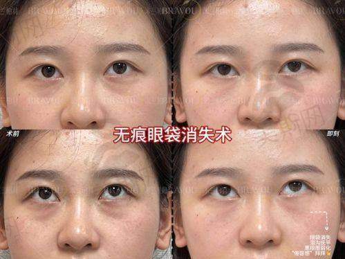 成都军大整形美容医院收费价目表之吸脂塑形:大腿/腰腹/全身价格明细