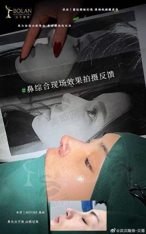 北京艺星王博谦医生技术