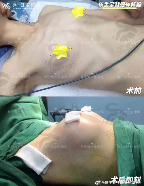 北京艺星王博谦医生价格表