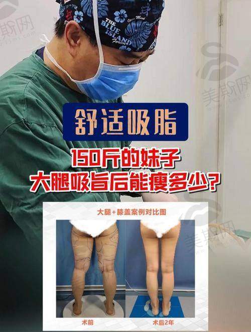 成都军大整形美容医院收费价目表无隐形消费:这些“坑”真的没有!