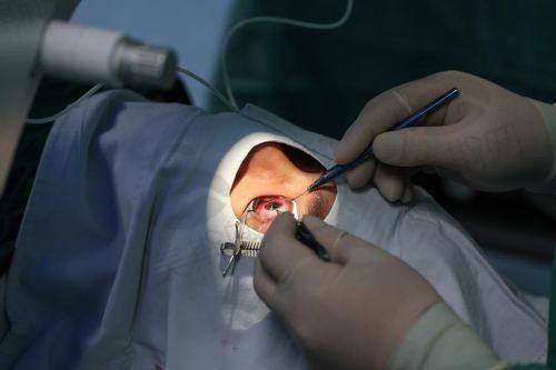 重庆南坪爱尔眼科医院蹇骞smile全飞秒17600元起,微创精准术后视力清晰恢复快