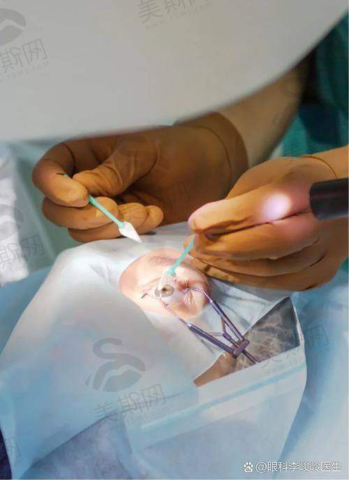 重庆佰视佳眼科赵小虎精雕绿飞秒14500元起,精雕精准术后视力清晰恢复快