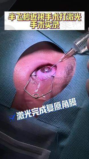 六、重庆佰视佳眼科赵小虎半飞秒10000元起 预约挂号指南