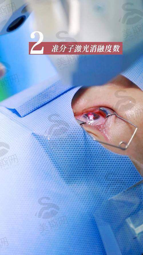 三、佰视佳赵小虎医生个性化半飞秒12000元起核心优势:定制矫正+设备精良+终身复查