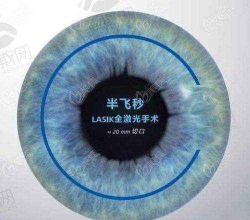 五、佰视佳眼科医院赵小虎坐诊实力:连锁品牌+正规资质保护个性化半飞秒成效