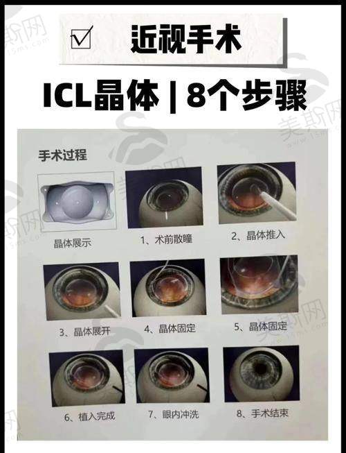 3.3 服务优势：术后专属护理，修复更贴心