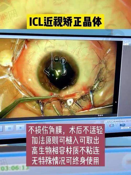 3.2 设备优势：术前检查严格，方案更精细