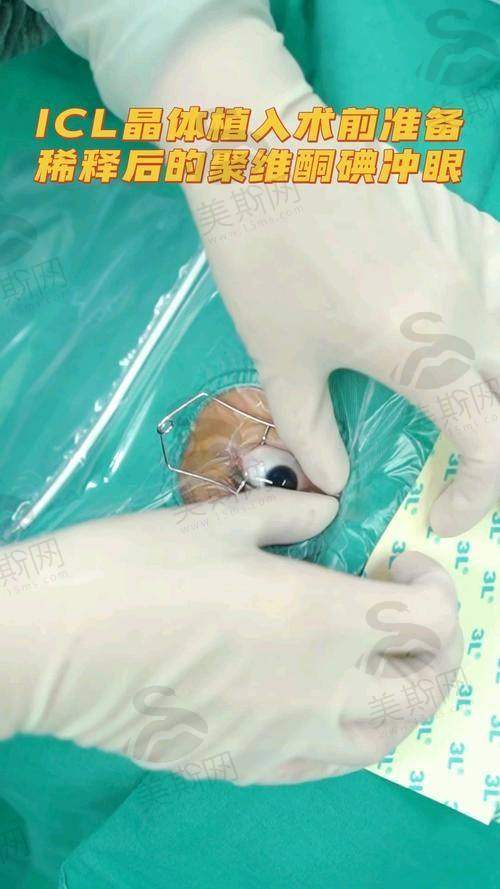 四、佰视佳赵小虎医生T - ICL晶体植入30500元起 真实口碑实例