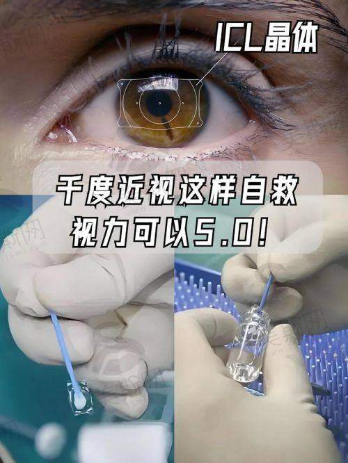 三、重庆佰视佳眼科赵小虎T - ICL晶体植入30500元起 核心优势