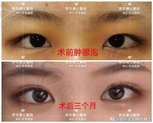 术前术后避坑指南