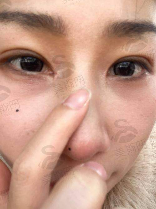 眼王刘志刚的技术优势