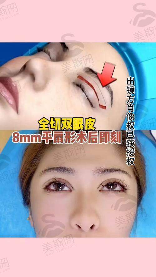 广州海峡医疗美容门诊收费价目表之“避坑指南”:这些钱千万不要白花!