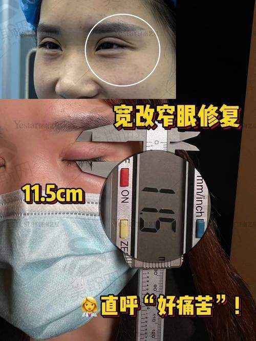 术前术后避坑指南