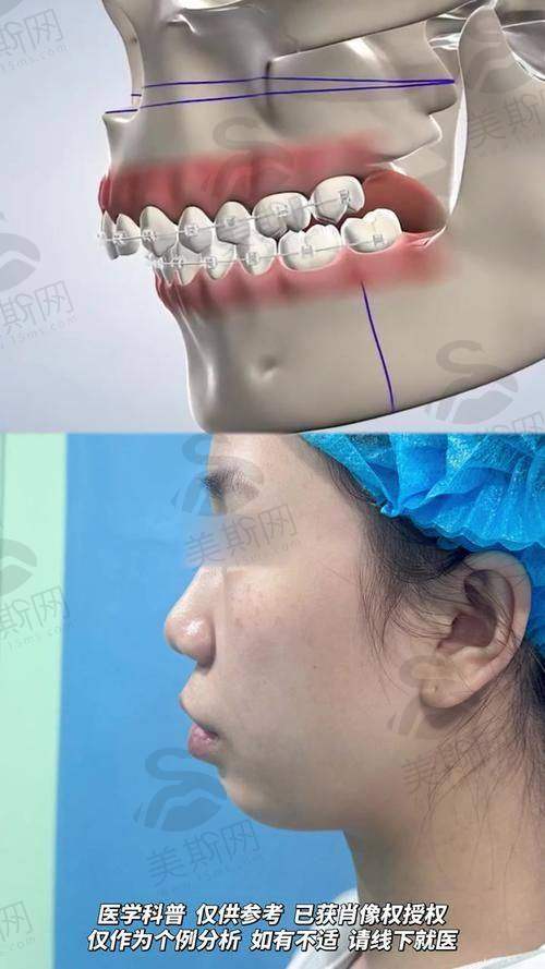 总结