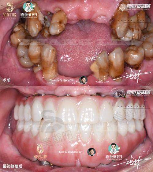 珠海拱北5分鐘牙科實測:港人愛三間邊間好?
