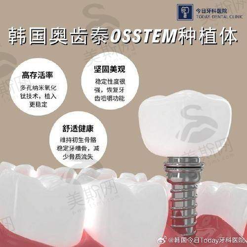 3. 珠海諾貝爾口腔:AI診斷夠先進,全口種植強項,但價錢稍高