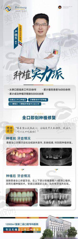 真相3：2025年種植牙品牌邊款更抵？醫生推薦清單