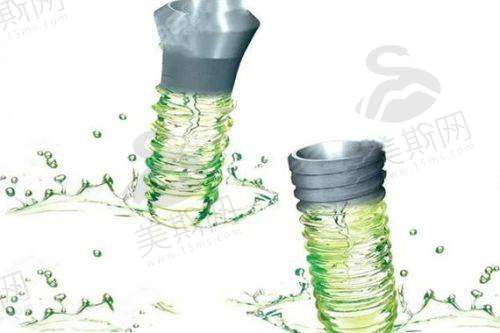 真相3:珠海拱北種植牙橋真係平過香港一半?有冇伏?