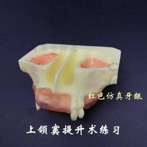 真相三:唔係人人都適合種牙