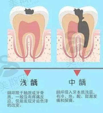 湊仔媽咪/返工族睇牙攻略:3招慳時間兼避坑