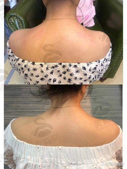 艺星整形美容医院价格表详情