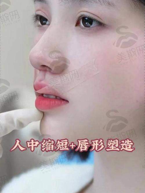 深圳非凡医疗美容整形医院王永祥医生技术揭秘