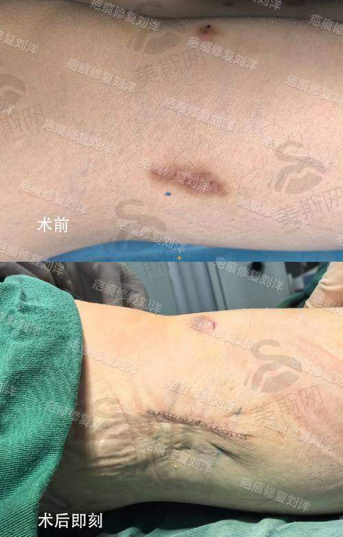 深圳悦尔医疗美容的精良技术