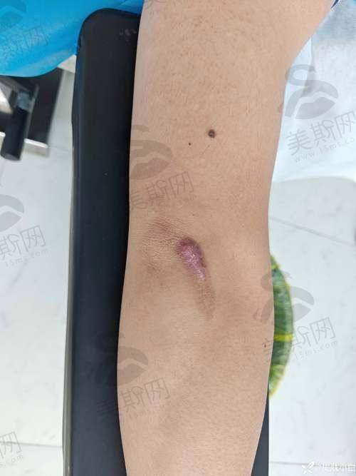 深圳悦尔医疗美容就诊小贴士