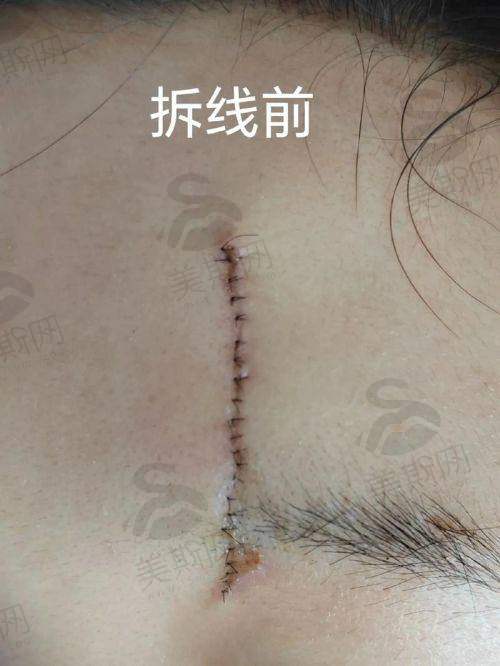 深圳悦尔医疗美容的价格与口碑