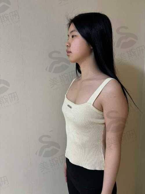 西 南医院美容整形科热门项目价格及选择要点