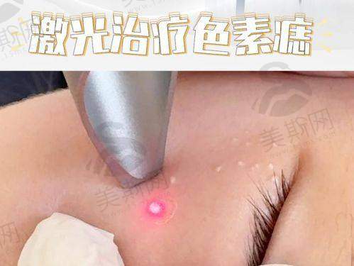 术前术后避坑指南