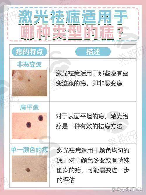 菏泽市立医院切痣价格及情况