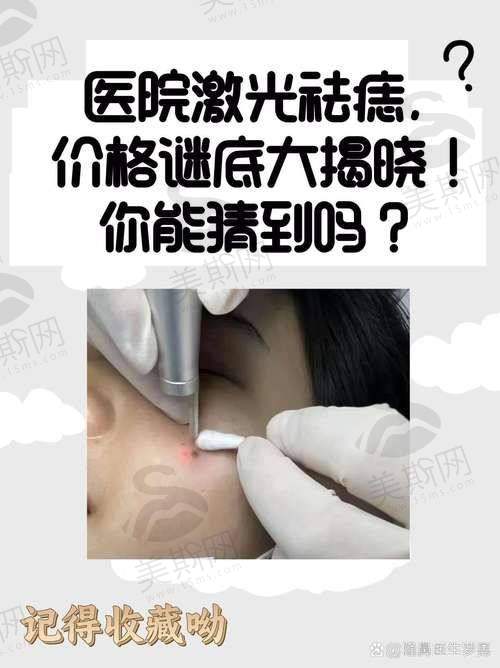 切痣关键选择点