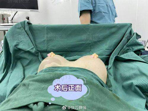 选择夏建军医生的术前术后避坑指南