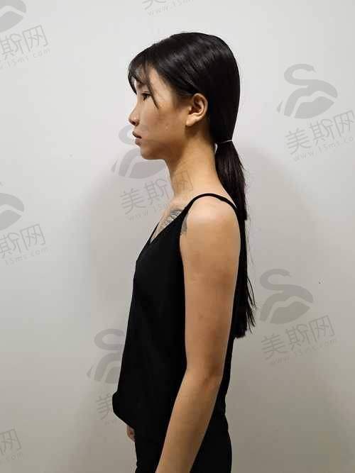 五、术前术后避坑指南:这些事千万别做!(血的教训)