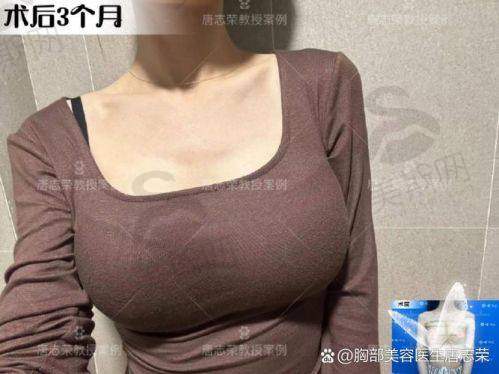 总结