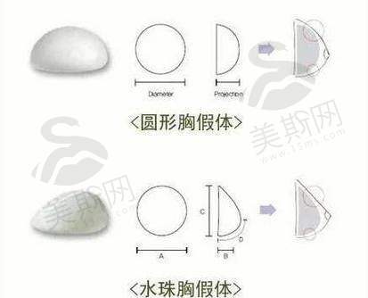 夏建军医生的缩胸技术优势