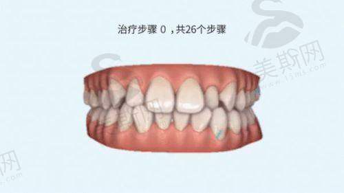 深圳美思特海西口腔门诊部怎么样？