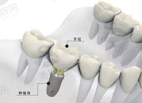 深圳美思特海西口腔门诊部预约挂号